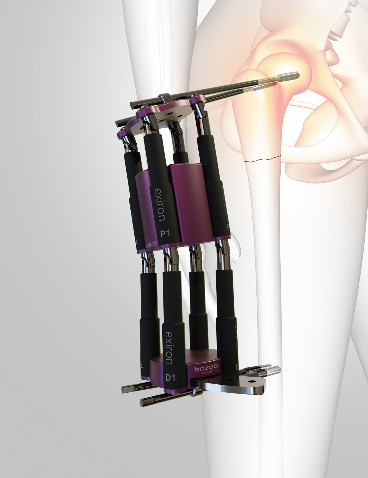 Exarane Injection Rod Exiron Bir Adım İleri